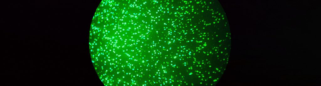 Freshly transfected CHO cells under the microscope