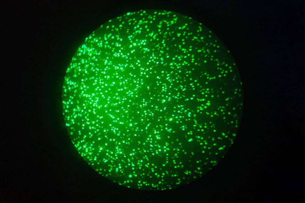 cho cells under the microscope