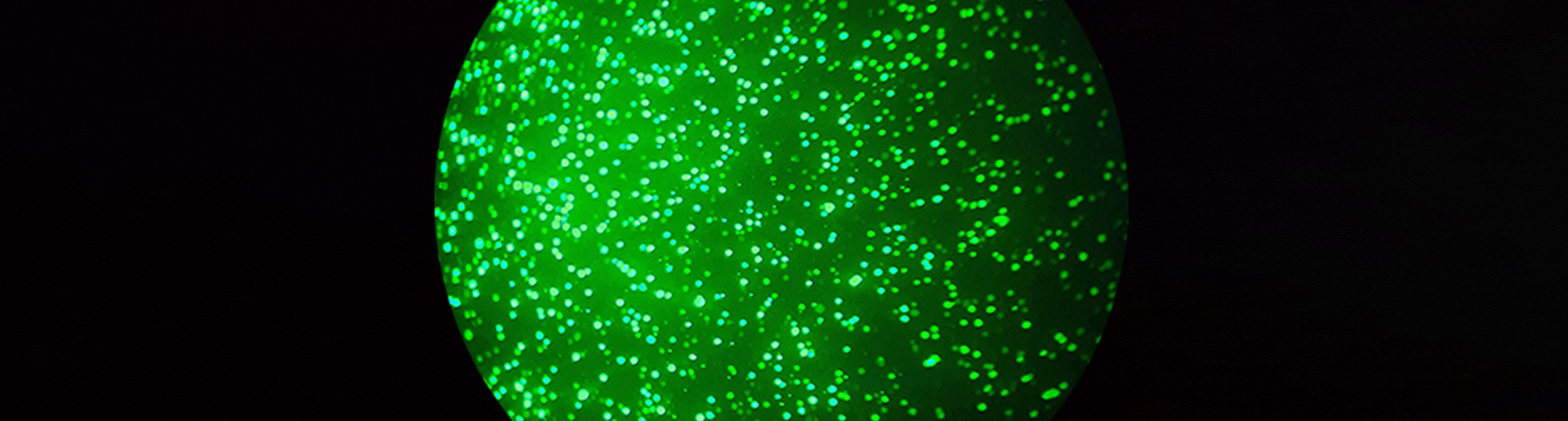 Freshly transfected CHO cells under the microscope